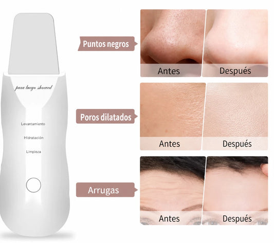 LIMPIADOR FACIAL 3 EN 1